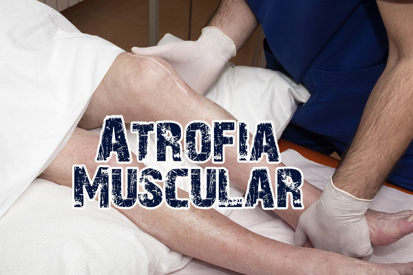 ¿Qué es la atrofia muscular espinal?