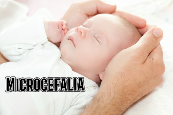 ¿Qué es la microcefalia en bebés?