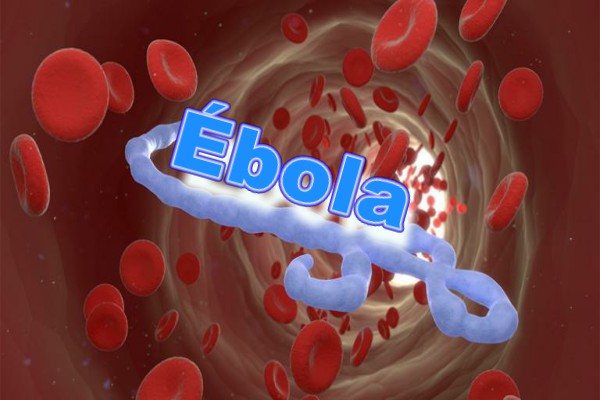 ¿Qué es el ébola?