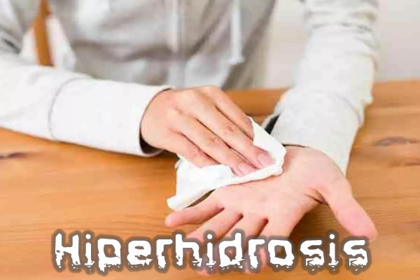 ¿Qué es la hiperhidrosis?