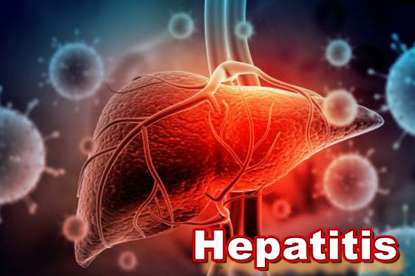 ¿Qué son las hepatitis?